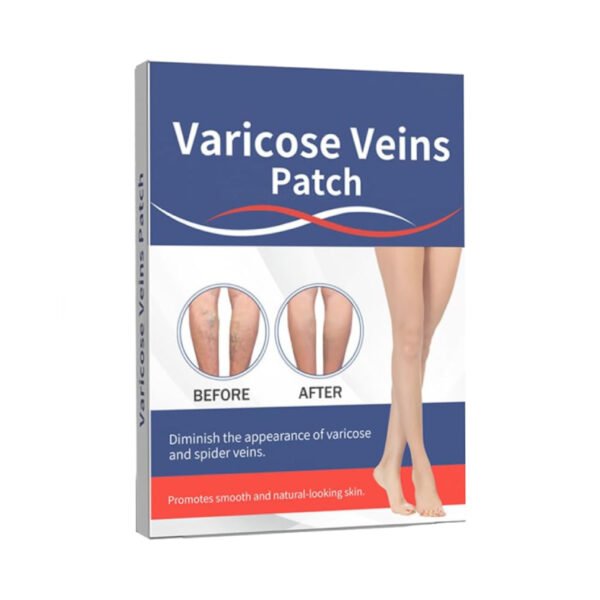 Varicose